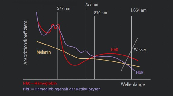 Laser Haarentfernung in Vechta